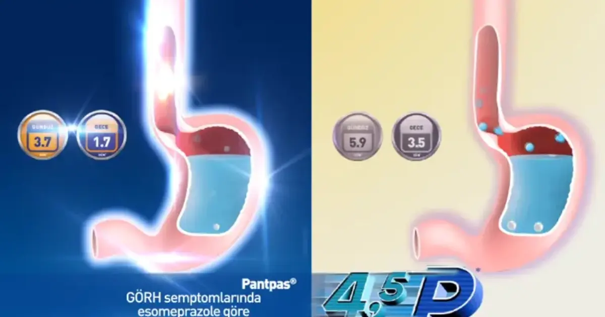 9 Things to Know About Pantpas – Your Guide to Managing GERD and Stomach Acid